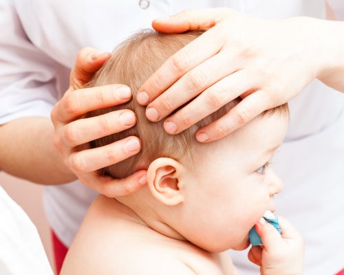 80033671 - seven month baby girl's head being manipulated by an osteopath - an alternative medicine treatment